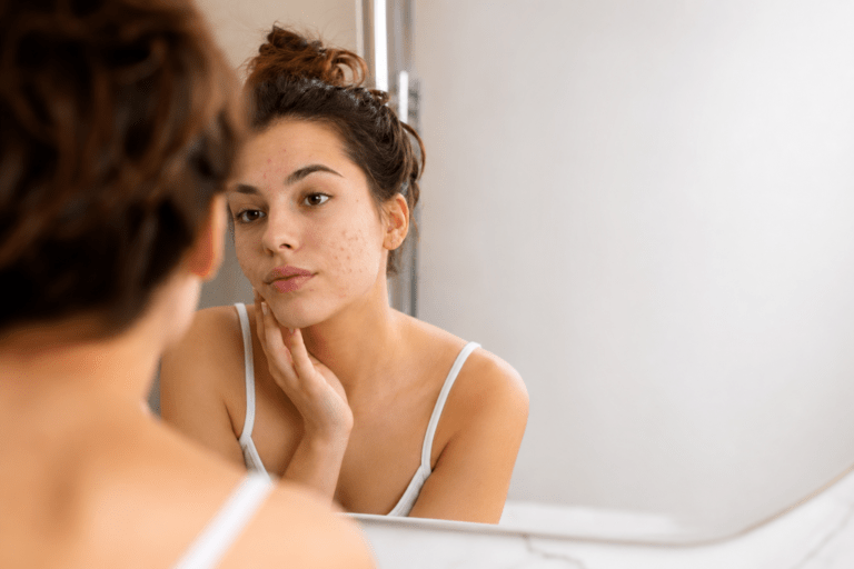 mujer mirandose la cara con granos y pensando en ingredientes antiacné
